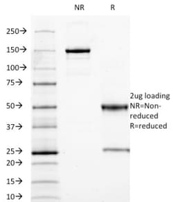CEACAM5/CD66e Antibody (C66/1009), Novus Biologicals 0.2mg; Unlabeled:Antibodies,
